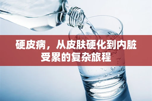 硬皮病，从皮肤硬化到内脏受累的复杂旅程