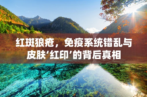 红斑狼疮，免疫系统错乱与皮肤‘红印’的背后真相