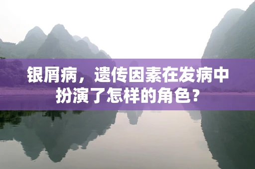 银屑病，遗传因素在发病中扮演了怎样的角色？