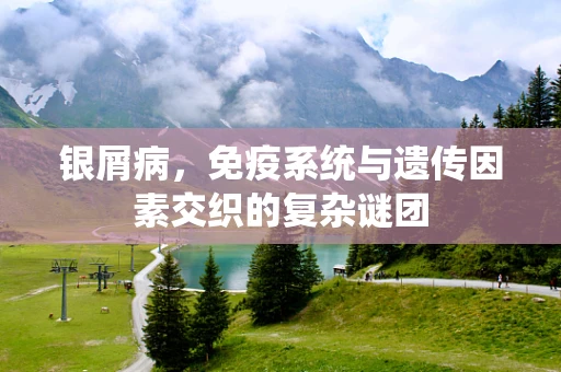 银屑病，免疫系统与遗传因素交织的复杂谜团