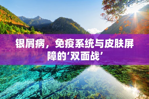 银屑病，免疫系统与皮肤屏障的‘双面战’